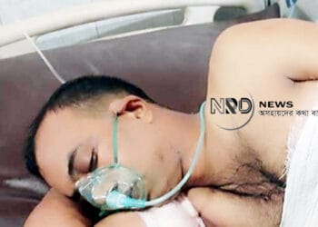 সিলেটে ভাইয়ের বাটালের আঘাতে গুরুতর আহত ভাই