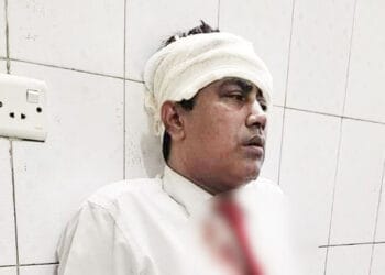 মৌলভীবাজারের লতিফকে সিলেটে ট্রেনে পাথর নিক্ষেপ, অত:পর…