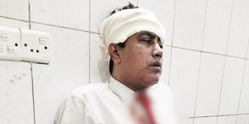 মৌলভীবাজারের লতিফকে সিলেটে ট্রেনে পাথর নিক্ষেপ, অত:পর…