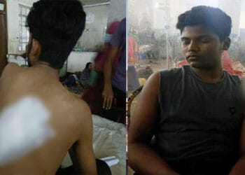 সিলেটে ছিনতাইকারীর হামলায় আহত ২ তরুণ, গ্রেফতার ১