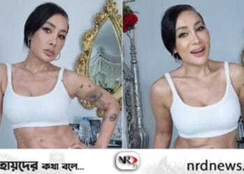 পেটে কীসের দাগ সোফিয়ার ?