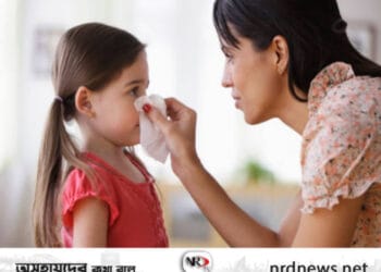 শিশুদের অ্যালার্জি হতে পারে যেসব কারণে