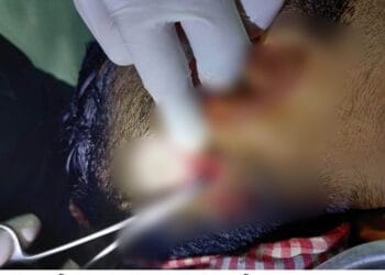 রূপগঞ্জে গুলিবর্ষণের ঘটনায় দশ দিনেও মামলা রুজু হয়নি আতঙ্কে বাদীপক্ষ