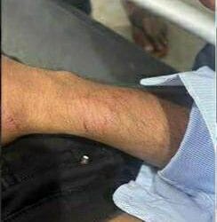 কয়রায় হামলার শিকার জবি অধ্যাপক নজরুল ইসলাম