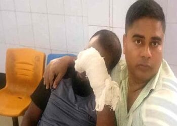 কোরবানির গরুর লাথিতে ভেঙেছে হাড়, কেটেছে হাতের রগ!