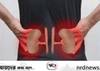 কিডনির অসুস্থতা ৫ লক্ষণে বুঝে নিন