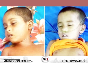 ব্রাহ্মণবাড়িয়া ইঁদুরের বিষ খেয়ে ২ শিশুর মৃত্যু