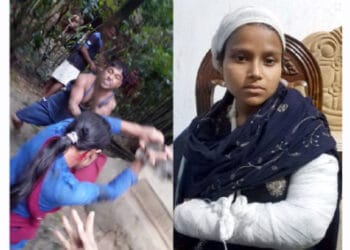 প্রতিপক্ষের হামলায় কানাইঘাটে পিতাসহ স্কুলছাত্রী আহত : আসামীরা অধরা