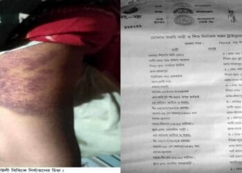 রাণীনগরে যৌতুকের দাবিতে ২য় স্ত্রীকে নির্যাতনের অভিযোগ আ.লীগ নেতার বিরুদ্ধে