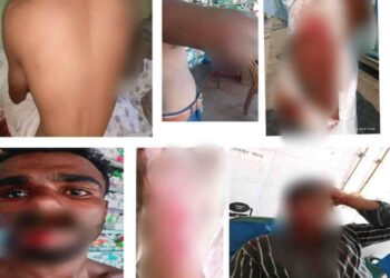 সুনামগঞ্জে যুব অধিকার পরিষদের সভায় ছাত্র লীগ যুব নেতাকর্মীদের কে রক্তাক্ত করেছে