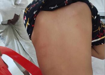 রাণীনগরে মাদ্রাসা ছাত্রকে নির্যাতনের অভিযোগ প্রধান শিক্ষকের বিরুদ্ধে