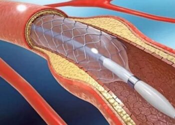 তিন কোম্পানির রিংয়ের দাম কমলেও ২৮টির দাম অপরিবর্তিত