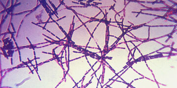 অ্যানথ্রাক্স প্রতিরোধে প্রাণিসম্পদ অধিদপ্তরের দেশজুড়ে জরুরি অভিযান