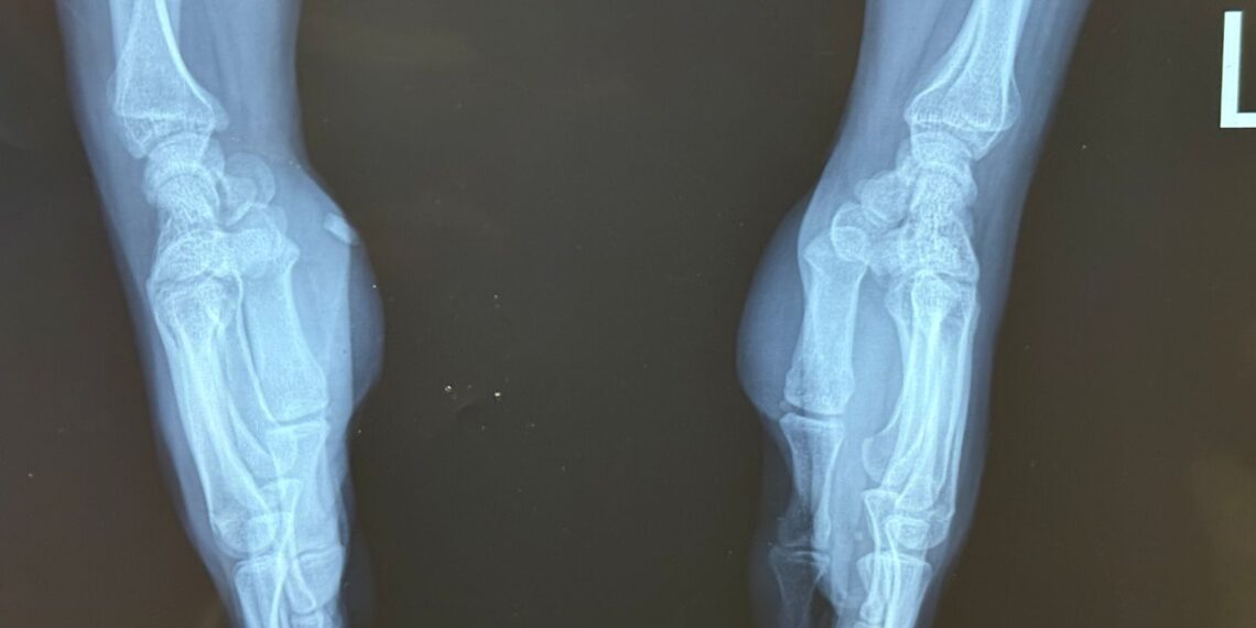 রাজধানীর কাফরুল এলাকায় ঘটে যাওয়া এক দুর্ঘটনা আবারও প্রশ্ন তুলেছে দেশের চিকিৎসা ব্যবস্থার মান