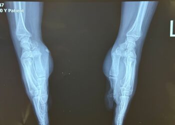 রাজধানীর কাফরুল এলাকায় ঘটে যাওয়া এক দুর্ঘটনা আবারও প্রশ্ন তুলেছে দেশের চিকিৎসা ব্যবস্থার মান