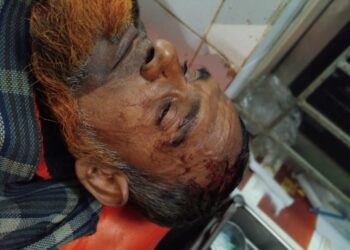 মোহনগঞ্জে গভীর নলকূপ স্থাপন নিয়ে সংঘর্ষ, দা-বল্লমের আঘাতে দুইজন গুরুতর আহত