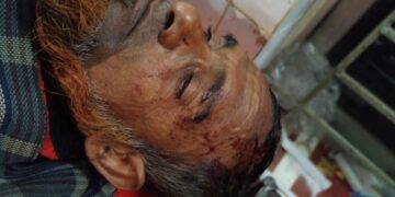 মোহনগঞ্জে গভীর নলকূপ স্থাপন নিয়ে সংঘর্ষ, দা-বল্লমের আঘাতে দুইজন গুরুতর আহত